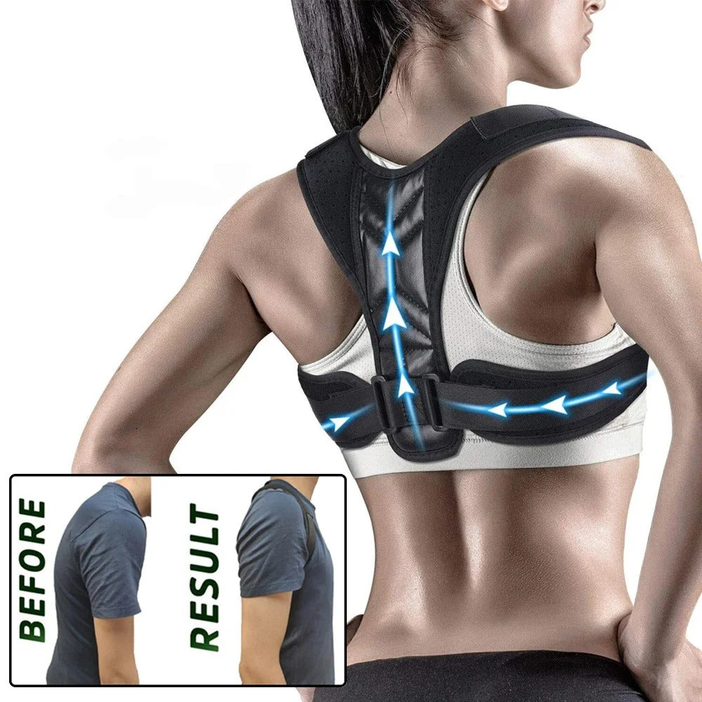Back Posture Corrector Belt – Adjustable Spine & Shoulder Support for Men & Women